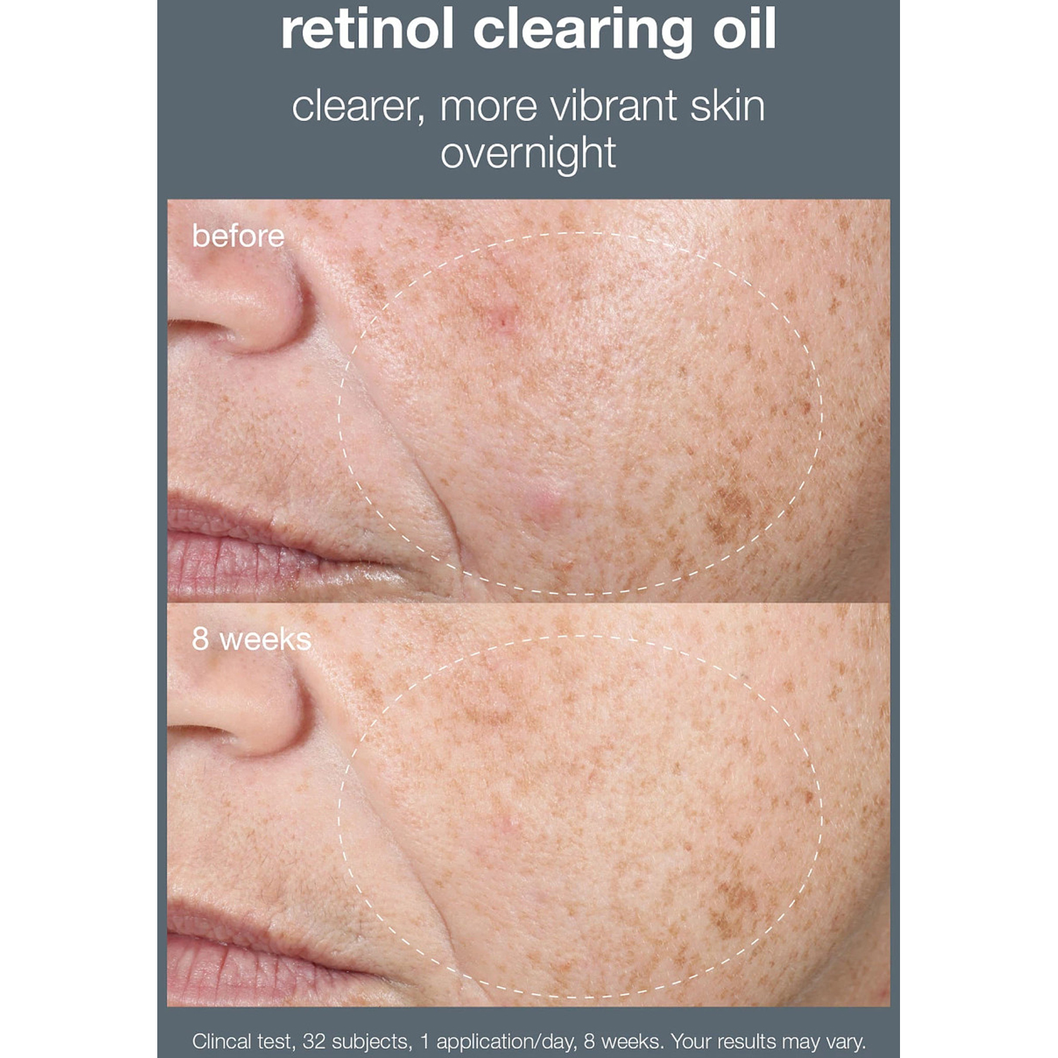 Retinol Clearing oil