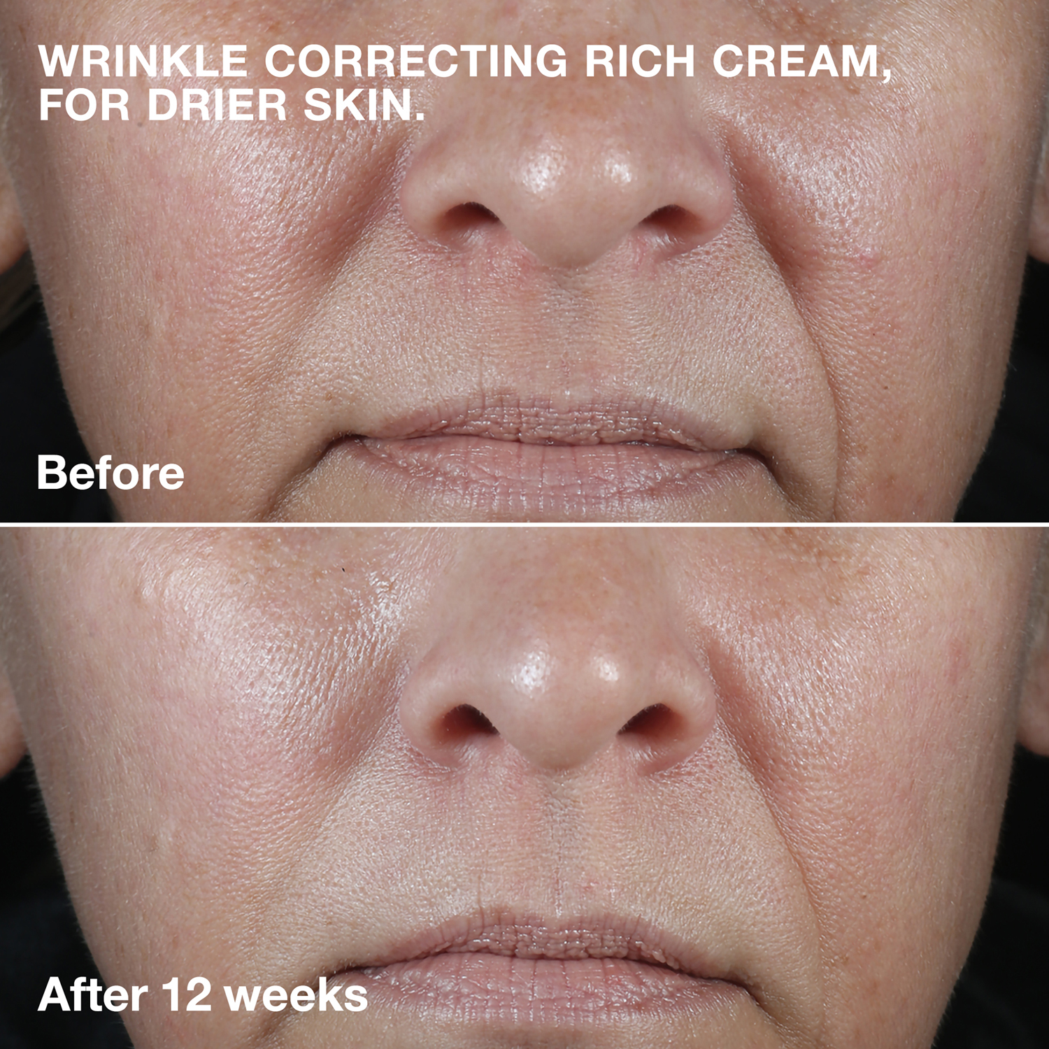 Smart Clinical Repair Wrinkle Face Cream Rich